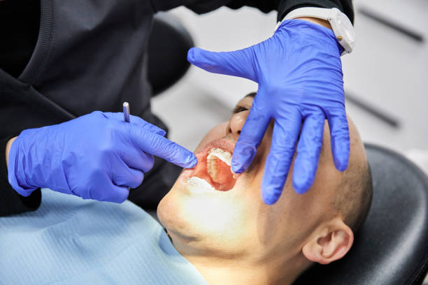 Best Emergency Gum Treatment in Beechwood, MI