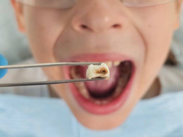 Best Emergency Denture Repair in Beechwood, MI
