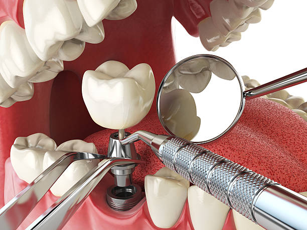Best After-Hours Dental Trauma Care in Beechwood, MI